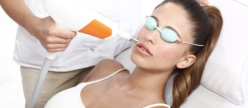 Resurfacing cutaneo con laser